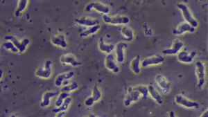 health-ameebia-ill-cough-throught-infection