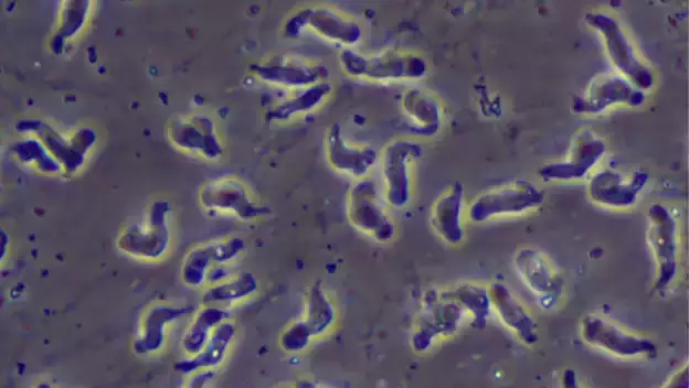 health-ameebia-ill-cough-throught-infection