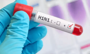 h1n1-hospital-treatment-blood-test