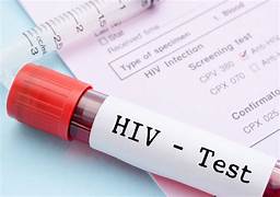 hiv-test-labs-closed-hospitals-spred-the-hiv-casess