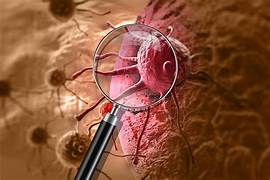 cancer-food-health